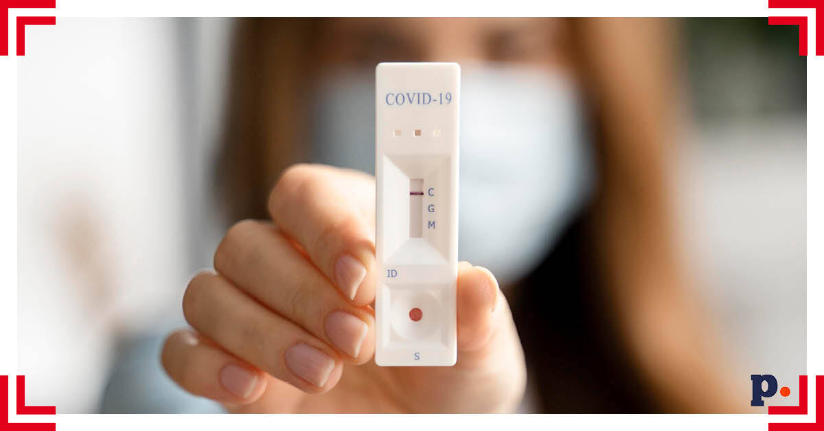 Testy na koronawirusa